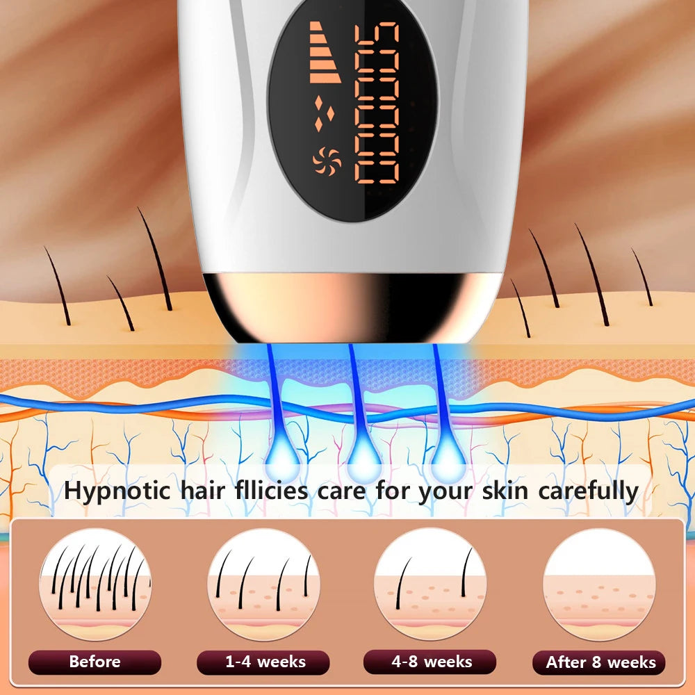 999,999 Flashes IPL Laser Hair Removal – Permanent & Painless Epilator for Face, Legs, Bikini & Body